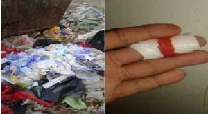 صورة اليوم ..اصابة عامل نظافة بالسويس من المخلفات الطبية الملقاة بجوار الصندوق بقرية العمدة