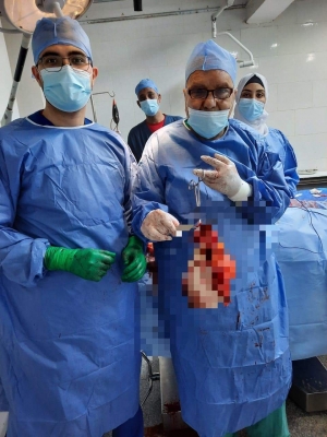 قسم جراحة الأورام بمستشفي السويس العام يواصل نجاحاته بإجراء العمليات الكبري والدقيقة