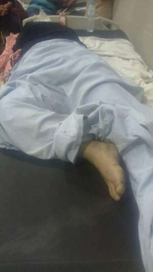 بالصور:سقوط أسانسير مستشفى السويس العام بسيدة واصابتها بكسور.. والمدير: &quot;أنا مالى تعمل محضر&quot;