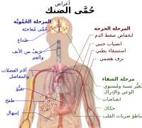 مــاذا تـعــرف عــن حُـمـى الـضـنــك ؟!